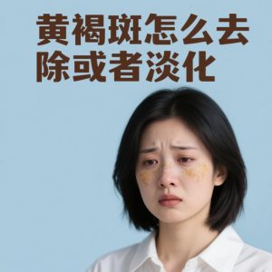 黄褐斑怎么去除或者淡化？