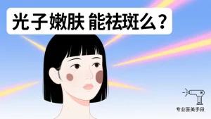 光子嫩肤能祛斑么？