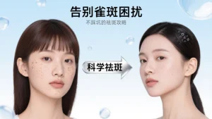 如何去除雀斑效果好？