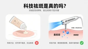 科技祛斑是真的吗？别让 “传统误区” 耽误你的淡斑路