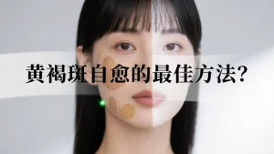 黄褐斑自愈的最佳方法？别让 “蝴蝶斑” 成为颜值心结