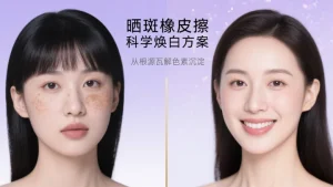 晒斑拜拜！3 步解锁无斑净白肌，白白兔门店带你科学淡斑不踩坑
