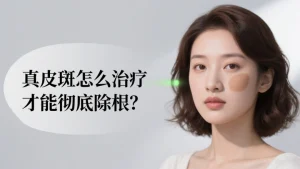 真皮斑怎么治疗才能彻底除根？