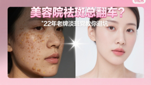 美容院祛斑真的能去掉吗？