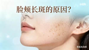 脸颊长斑的原因？