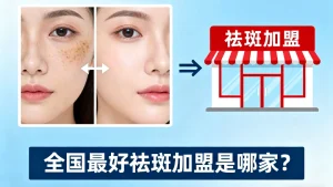 全国最好祛斑加盟是哪家?