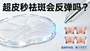 超皮秒祛斑会反弹吗?