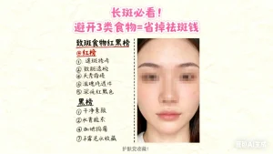 脸上长斑的人不能吃什么食物？