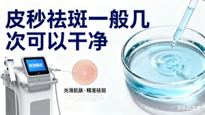 超皮秒祛斑一般几次可以干净？