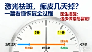激光祛斑几天掉痂？脱落时间及护理