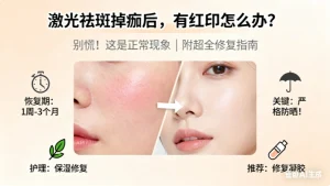 激光祛斑掉痂后有红印子正常吗？多久恢复？怎么办？擦什么药？