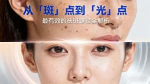 祛除晒斑最有效的方法推荐