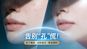 毛孔粗大适合什么医美？