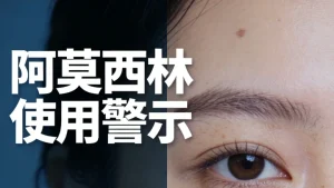 阿莫西林敷脸可以祛斑吗？