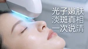 光子嫩肤能淡斑吗｜真相揭秘 适合谁/不适合谁