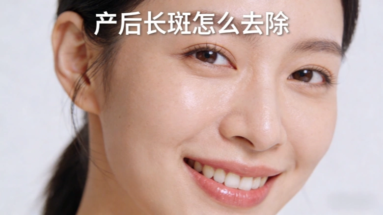 产后长斑怎么去除？｜拒绝偏方，专业干货看这篇就够了