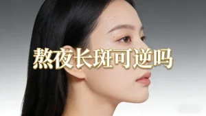 熬夜脸上长斑可以恢复吗？科学解答+实操攻略