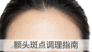 额头长斑怎么调理才能去掉？针对性解决不踩雷