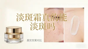 淡斑霜真的能淡斑吗｜真话实说 能淡但不神化