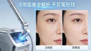 淡斑做什么医美｜一篇讲透 不踩坑不花冤枉钱