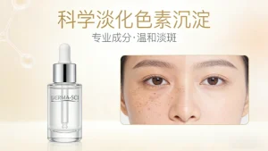 脸上皮肤色素沉淀怎么去除？别乱美白！科学淡化不反黑