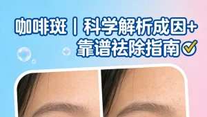 咖啡斑是怎么形成的？怎么祛除