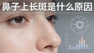 鼻子上长斑是什么原因？别再瞎猜了