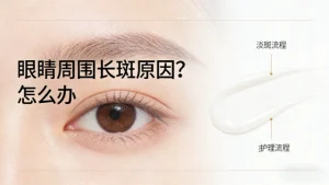 眼睛周围长斑？原因+解决办法全搞定