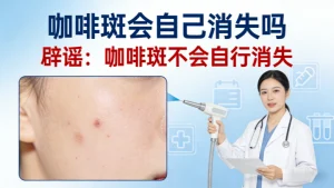 辟谣！咖啡斑会自己消失吗？