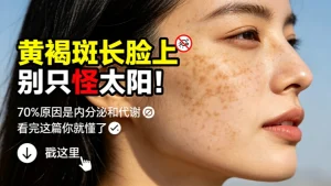 脸上起黄褐斑是什么引起的？（别再怪“晒黑”了）