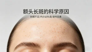 额头长斑的原因是怎么引起的？别乱涂！这5个科学原因才是根源