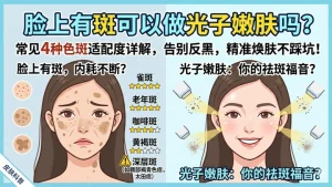 脸上有斑可以做光子嫩肤吗？本文详细解答
