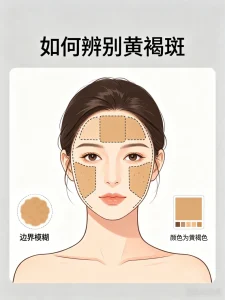 黄褐斑多久能淡化？真实案例告诉你正确改善路径